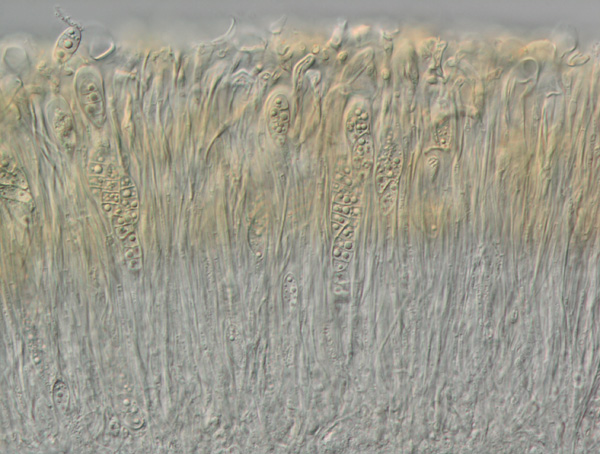 Enchylium tenax, Querschnitt durch das Hymenium mit Asci und Ascosporen [M. Schultz]