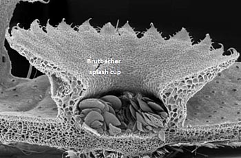 Marchantia polymorpha, Brutbecher quer; REM, © Honegger