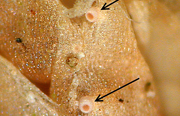 2 Fruchtkörper der parasitischen Flechte Absconditella sphagnorum auf Torfmoosblättchen; Foto: WvBrackel