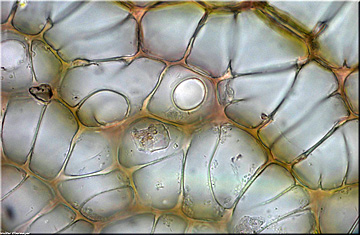 Sphagnum magellanicum, Hyalozyte mit Pore; Foto: WObermayer