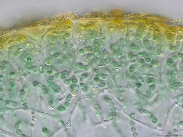 Enchylium tenax, Querschnitt durch das Lager mit Pilzhyphen und Ketten des Cyanobacteriums Nostoc [M. Schultz]