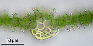 Phascum vlassovii, Blattquerschnitt mit Papillen; Foto: Stapper