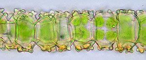 Tortula virescens, Blattquerschnitt mit Papillen; Foto: Stapper; man erkennt leicht, dass dieses Foto aus einer Fokusserie zusammengerechnet wurde (s. u.)