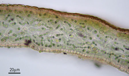 Leptogium corniculatum, Thallusquerschnitt mit Cyanobacterien; Foto: NJS